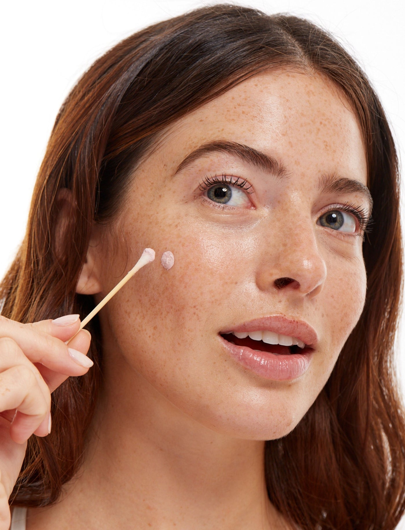 Loción de Skincare para el Control de brotes de acné de manera rápida y efectiva