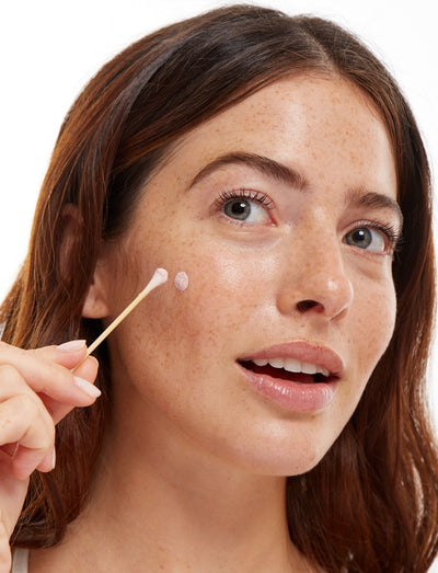Loción de Skincare para el Control de brotes de acné de manera rápida y efectiva